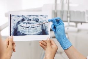 gallery/dentist-showing-x-ray-image-to-patient-tbv4z9u